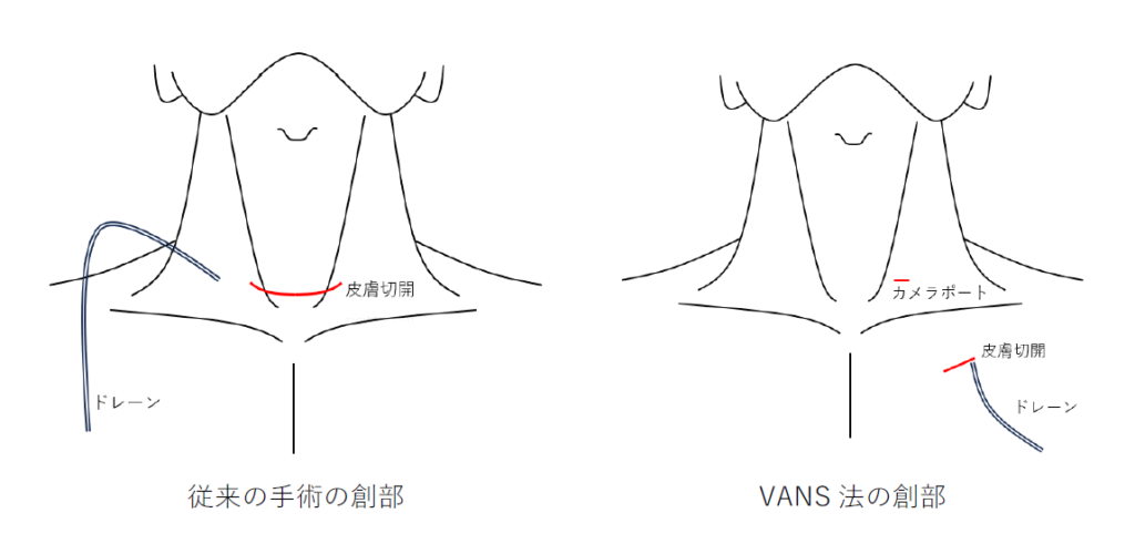 創部の比較 創部の比較